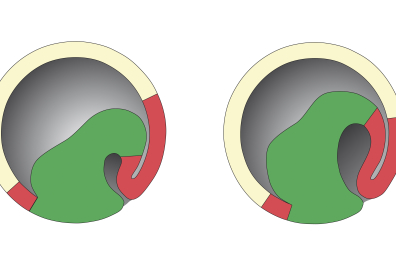 Embryogenèse des batraciens - gastrulation - infographie